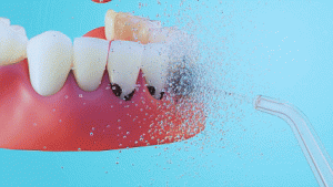 Revolutionize Your Oral Hygiene: Discover the P...